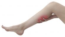 acute pain in a woman's calf.jpg